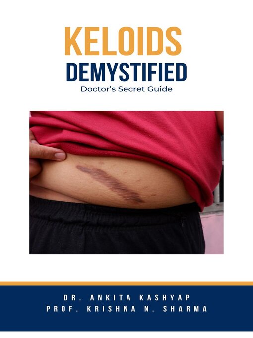 Title details for Keloids Demystified by Dr. Ankita Kashyap - Available
